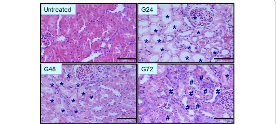 Fig. 1 Representative morphological changes in kidney shown with H&E staining at different time points after glycerol treatment