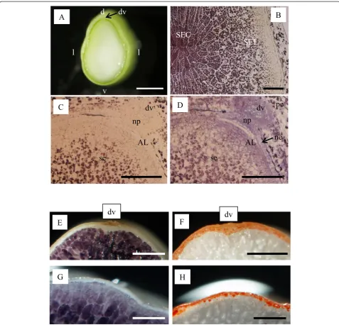 Fig. 1 Observation of endosperm cells at 7 DAF (starchy endosperm at the center (SEC) and lateral side (SEL) stained with iodine.stained with iodine (dorsal side,a–d) and in mature grain (e–h)