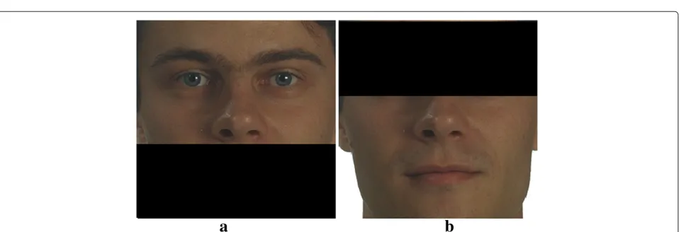 Figure 6 Definition of two occluded areas (one-third occlusion). (a) An example of type A occluded face