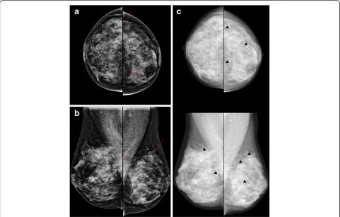 Table 4 Reading time for mammography and mammography with computer-aided detection (CAD)