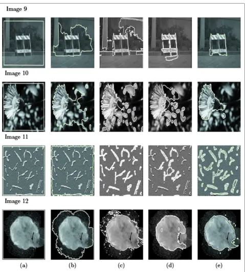 Figure 5 Comparison between the different active contour models. (a) First column original grey-level images with initial active contours(represented by white lines), (b) second column - segmentation results using gradient-based active contour, (c) third column - segmentationresults using region-based active contour of [31], (d) fourth column - segmentation results using region-based active contour of [30], and (e) fifthcolumn - segmentation results using polarity-based active contour.