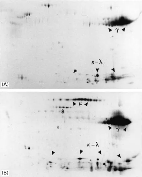 Figure 3B.Af�nity Chromatography Using Jacalin orComplement