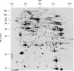Figure 2A 2-D separation of 100pattern was visualized by silver staining. The scale at the top indicates the nonlinear pH gradient obtained using an IPG 3-10 NL strip forthe first dimension IEF separation