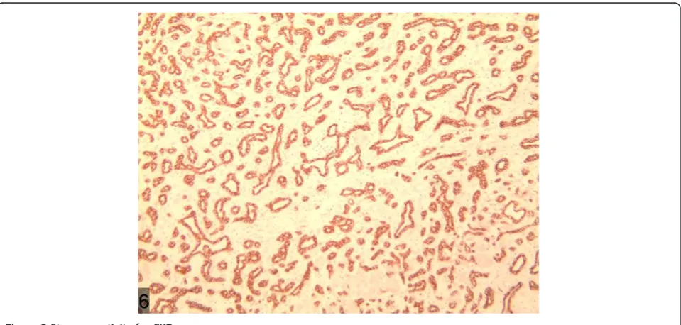 Figure 1 p53 stains were negative.