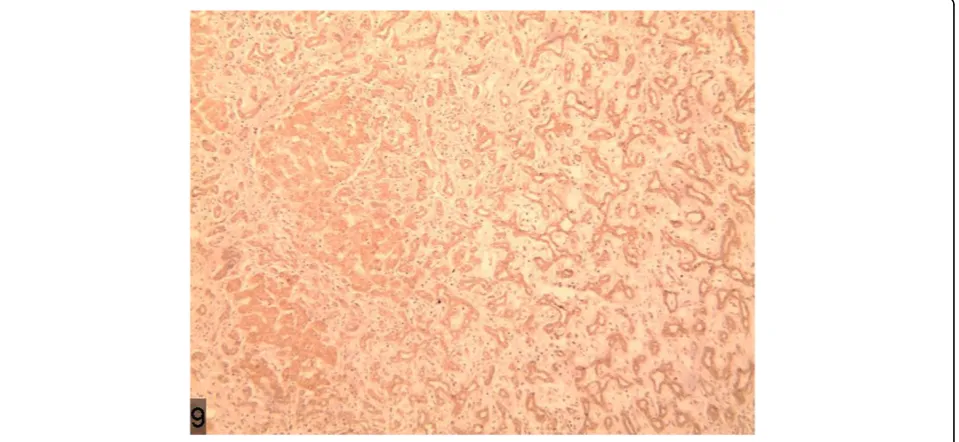 Figure 3 Strong reactivity for CK19.