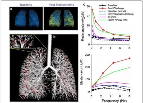Fig. 7 Overview of image functional modeling. a Terminal units are defined from the airway tree model which are subsequently mapped to the ventilation defects obtained from HP 3He MRI with ventilated terminal units depicted in blue and the nonventilated te