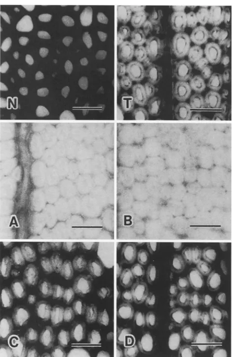Fig. 5. Micrographs of phtoroglucinol reaction on transverse sections. N, typical normal wood in control; T, typical tension wood at 14 days