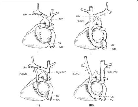 Table 1 Schummer’s classification of superior vena cava