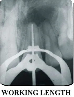 Figure 3.  Metapex placed in relation to 11   