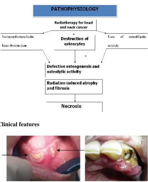Fig. 2. Legend- Joel B Epstein et al Fig. 3. Legend- S.S Deshpande et al.
