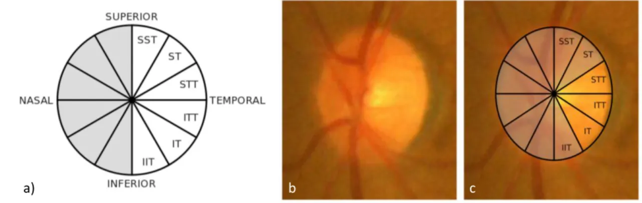 Figure 2.21: (a) Schematic diagram of division of optic nerve head (ONH) regions of a left eye, with nasal side  of the ONH greyed out as the measurements were discarded due to vascular shadowing