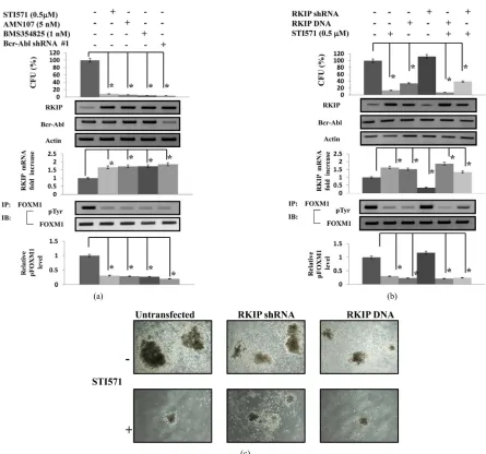 Figure 4. RKIP regulates FOXM1 activation on ALDHhi/CD34+ hematopoietic progenitor cells derived from CML patients