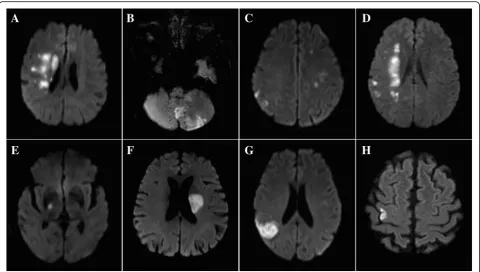 Fig. 1 Infarction patterns of single acute infarction and multiple acute infarctions. Multiple acute infarctions.b a Unilateral anterior circulation; Posterior circulation; c Multiple circulations; d Border-zone territories