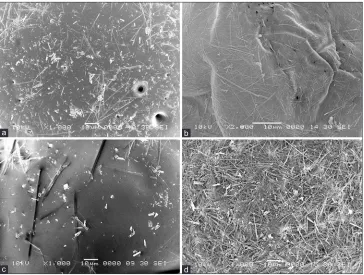 Fig. 1: Scanning electron microscope photomicrograph of microspheres.SEM photomicrograph of microspheres consists of (a) Eudragit® EPO and EC (drug:polymer [D:P]; 1:2), (b) hydroxypropyl methylcellulose (HPMC) EV 50 and ethyl cellulose (EC) (D:P; 1:2), (c) HPMC K4M and EC (D:P; 1:2), (d) HPMC EV 50 and EC (D:P; 1:1)