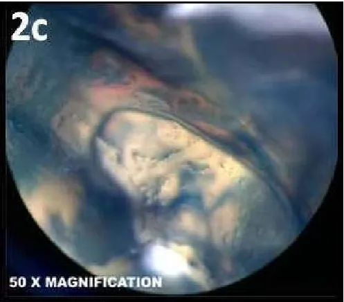 Figure 1c. Decalcified sample after India ink injection and clearing technique 