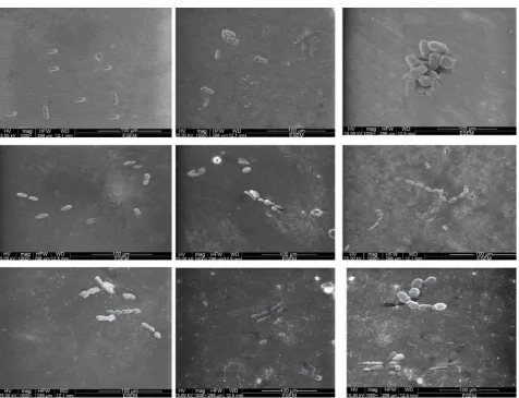 Figure 2. Two dimensional SEM micrographs of Streptococcus mutans ATCC 25,175 adhesion to the surfaces of resin composites polished with different  polishing systems: (A) FiltekZ350 XT with Mylar strip, (B) FiltekZ350 XT with Pogo one step, (C) Fil-tekZ350