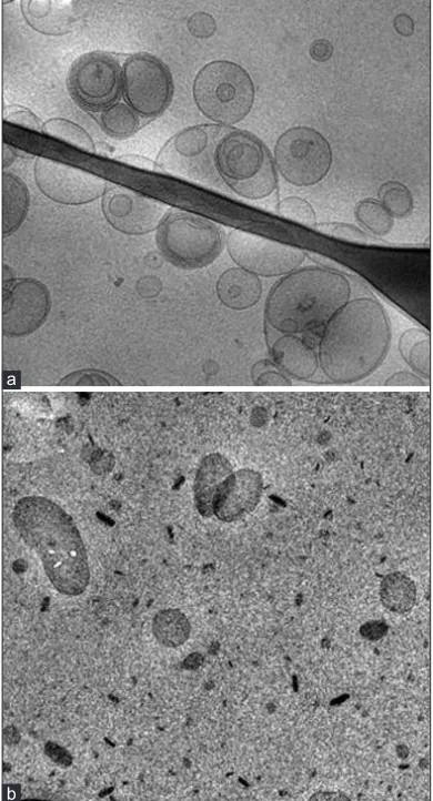 Fig. 1: Cryo-TEM photographs of ACY-containing ethosomes (Panel A) and SLN (Panel B) studied in the present paper