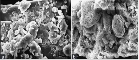 Fig. 1: Scanning electron micrographs(a) Physical mixture (Avicel pH 102 with SSL-Hydroxypropylcellulose).(b) Spray dried excipient base