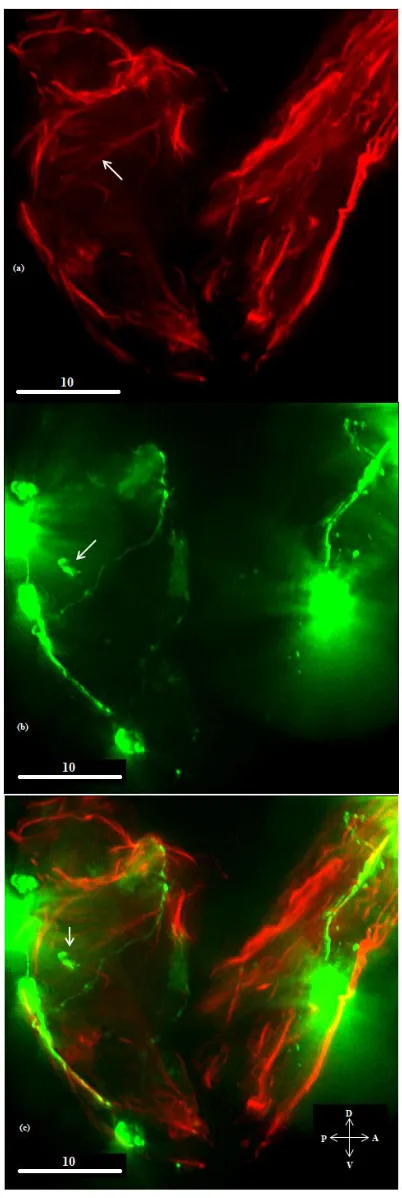 Figure 6 – Ectopic muscle innervated by DD motor neurons.  