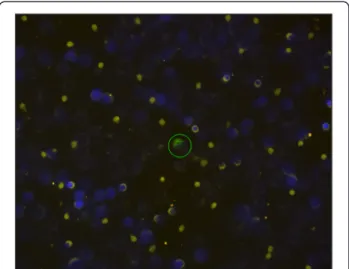 Figure 1 Cytokeratin staining of DTCs isolated from bone marrow by immunofluorescence.