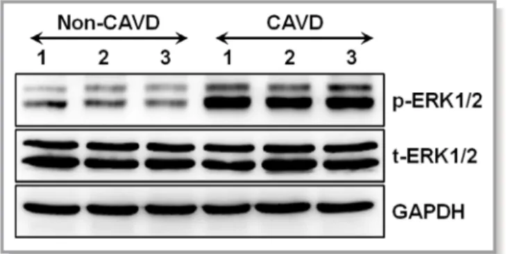 Figure 9. The expression of extracellular signal-regulated kinase (ERK) 1/2 in the calci ﬁc aortic valve disease (CAVD) group with increased leptin levels and in the non-CAVD group with normal leptin levels