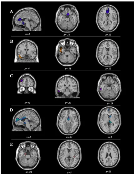 Figure 1to reference T1-weighted MRI imageMaps of significant voxels representing regions of hypoperfusion in FTLD patients according to clinical diagnosis, superimposed Maps of significant voxels representing regions of hypoperfusion in FTLD patients acco