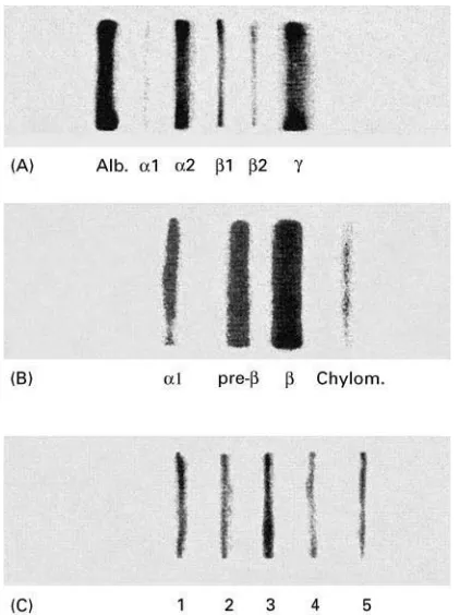 Table 2Some recent applications of CA electrophoresis