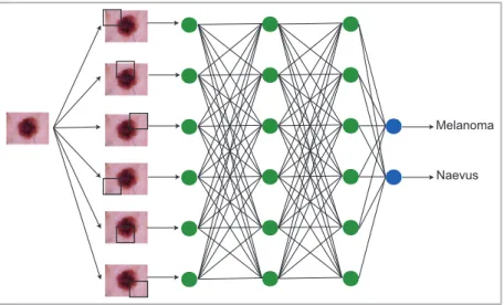 Figure 3 Schematic depicting how classification tasks are performed in convolutional neural networks