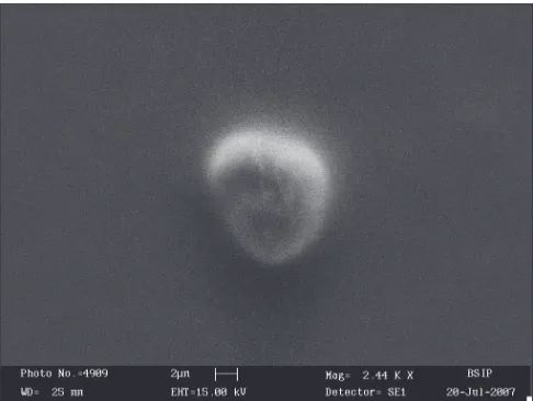 Fig. 1: Transmission electron microphotograph Visualization of ethosomes by transmission electron microscopy (˜8400)