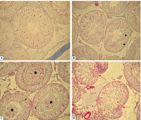 Figure 2. Immunoexpression of androgen receptor in the testis of control (A) and letrozole-treated rats (B)