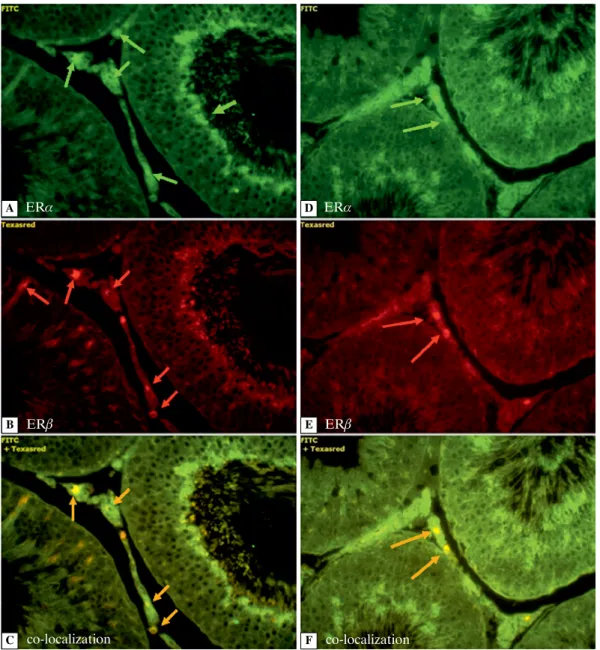 Figure 4. The immunoexpression of ERa (green fluorescence) and ERb (red fluorescence) in testis of control (A–C) and  letrozole-treated rats (D–F)