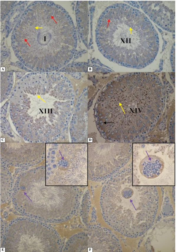 Figure 5. Immunolocalization of TRPV1 in testis of control (A, B) and letrozole-treated rats (C–F)