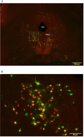 Figure 4. Low and high magnification of midbrain at the level of the periaqueductal gray (PAG) with PRV-