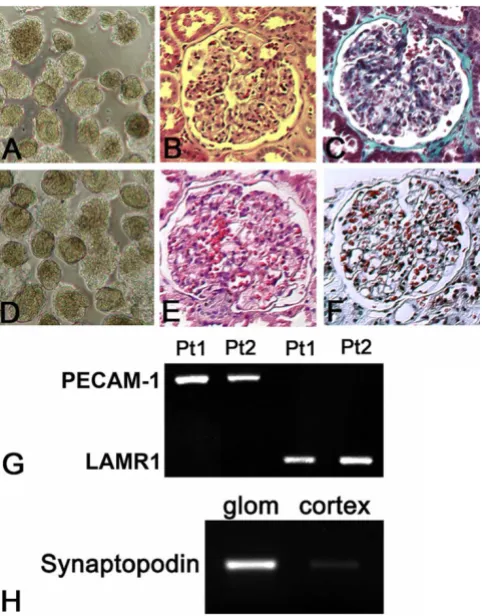 Figure 1Human Kidney Source MaterialEnrichment of the synaptopodin mRNA abundance, deter-mined by RT-PCR, in glomeruli relative to whole kidney cor-tex from patient 2 Human Kidney Source Material
