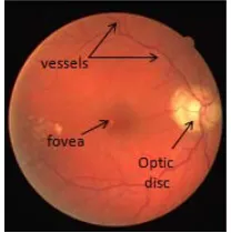 Figure 1. Retinal anatomy. 