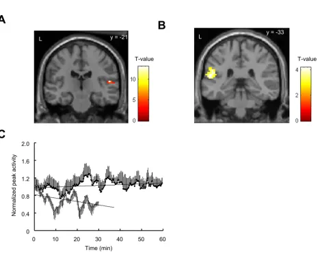 Figure 6Activity related to noise reduction by regression analysesActivity related to noise reduction by regression analyses