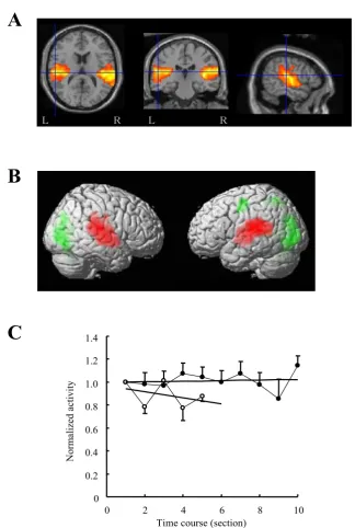 Figure 5Activity related to transient reduction of fMRI acquisition noiseActivity related to transient reduction of fMRI acquisition noise