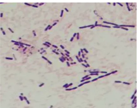 Figure 1: The results of Gram staining isolation of TP10-1 bacteria with 10x100 magnification 