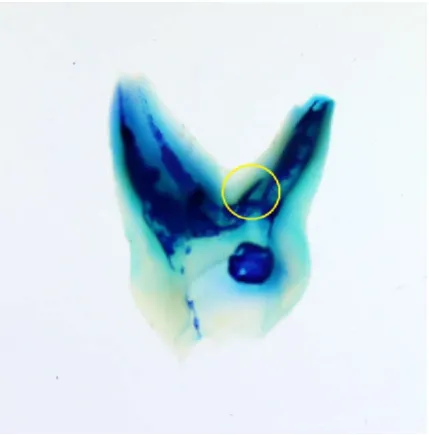 Figure 2.c middle one-third of root canal 
