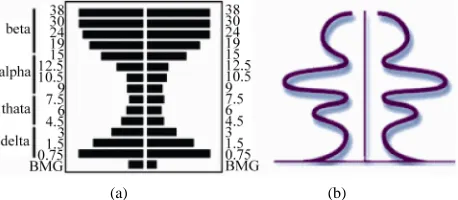 Figure 1. a) Example of a pattern of electrical activity of the brain
