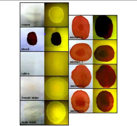 Fig. 1 Specificity and interference of Mini BLUMAXXlighting (left) and blue light viewed through orange barrier filter goggles (right)