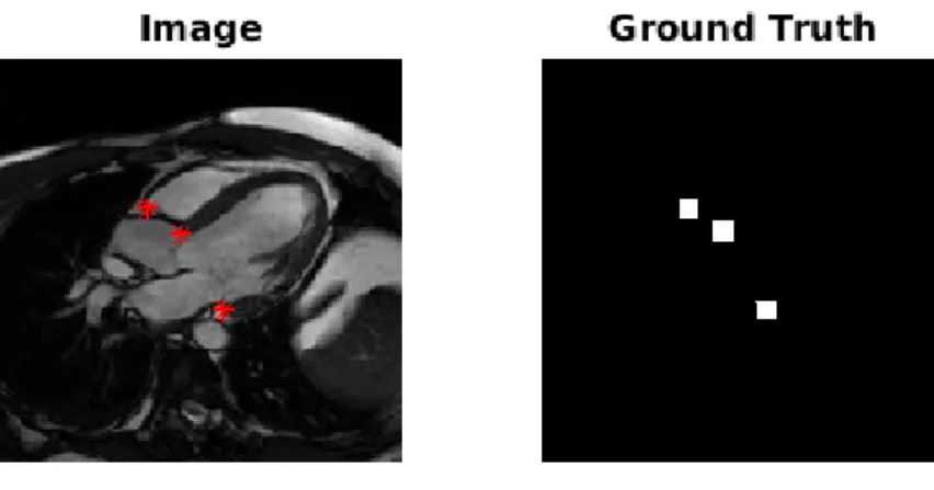 Figure 8: Example image and its ground truth for Landmark Detection. The landmarks are highlighted in the original image.