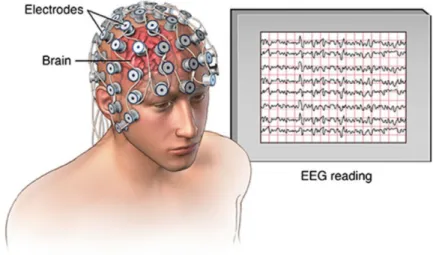 Figure 2.2.2. An illustration of EEG electrodes and signal [2].