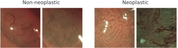 Fig.  6. Examples  images  of  the  two  classes  from  the  NBI-high-magniﬁcation  database Hiroshima