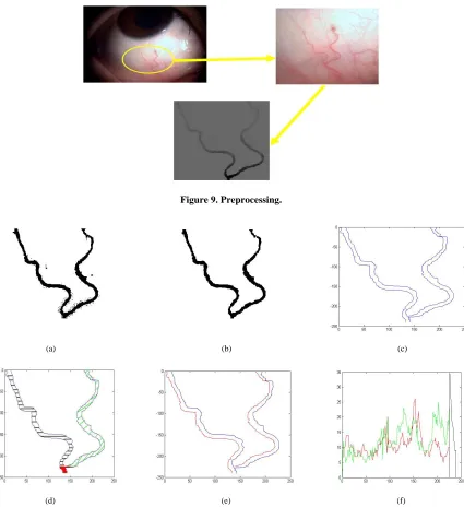 Figure 9. Preprocessing. 