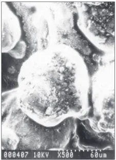 Fig. 1: SEM image of rifampicin-loaded microcapsules. Scanning electron micrographs of rifampicin-loaded microcapsules (MC1) prepared by ionic gelation process taken at scope magniﬁ cations of ×500.