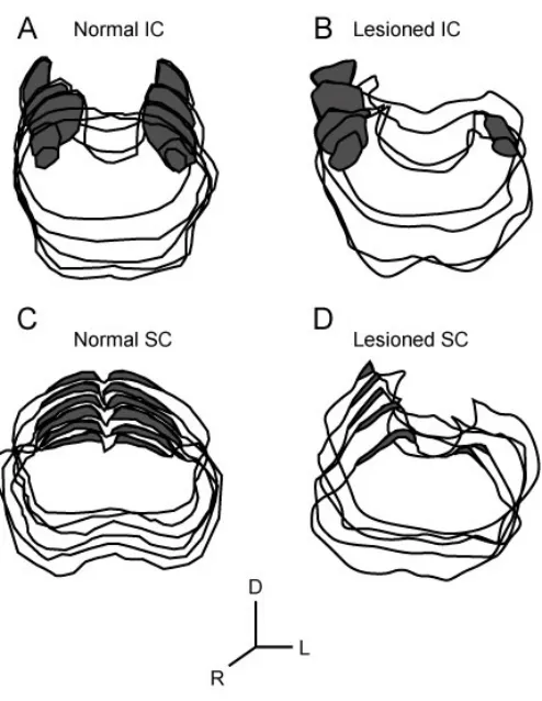 Figure 3.2.  Assessment of midbrain damage. Dark areas represent the central nucleus of the 