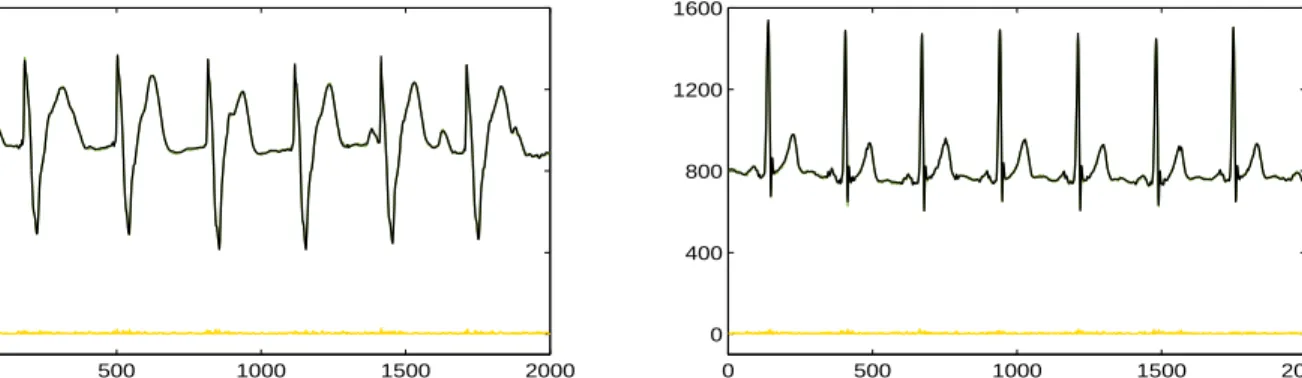 Fig. 3 depicts the approximation and raw data (indistinguishable in the scale of the graphs) of 2000 points in the records 107 and 116.