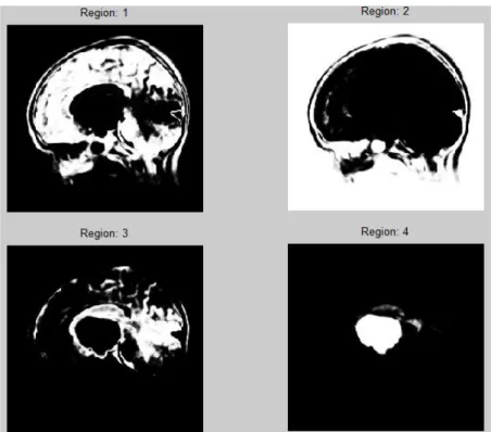 Fig. 4 Region based image segmentation 