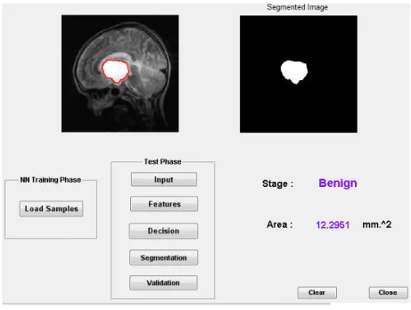 Fig. 5 Segmented area calculation 
